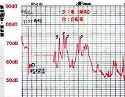 記録例